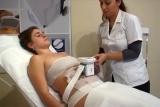 Crioliplisis: alquiler de equipos Lipocell Crio